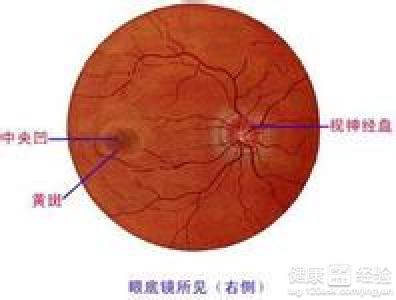 視網膜病應該如何治療？