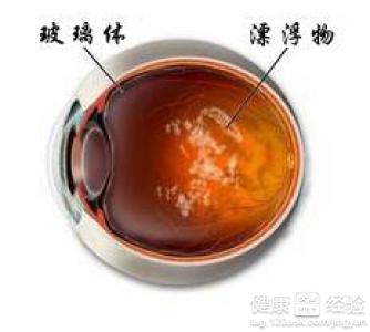 第1步