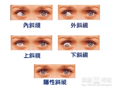 第1步