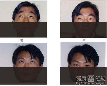 第2步