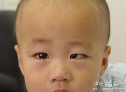 第2步
