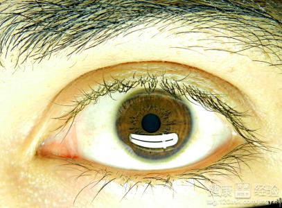眼睛間歇性外斜視怎麼治療