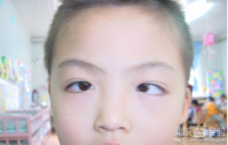 第2步