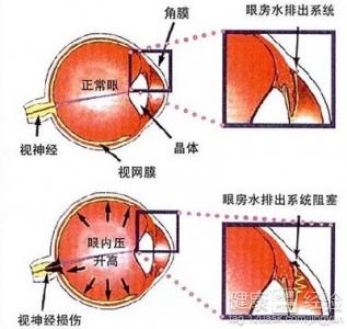 第1步