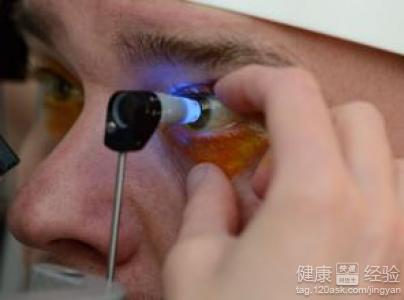 青光眼容易誤診青光眼應該做哪些檢查