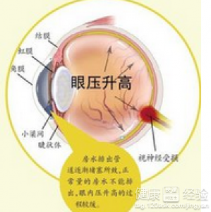 白領一族每天對電腦當心患上青光眼