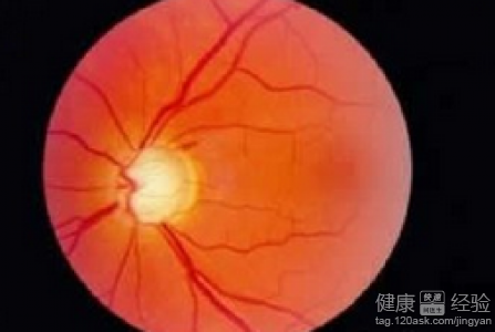 第1步