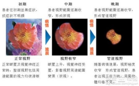 第1步