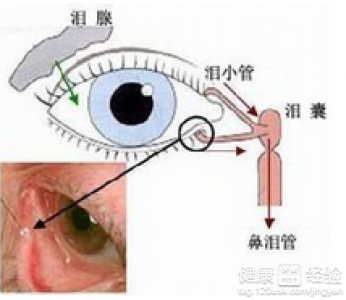 青少年型青光眼治療方法有哪些