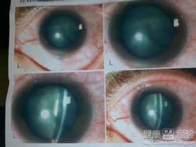 第1步