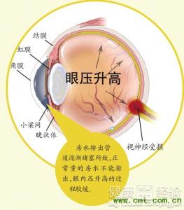 第1步