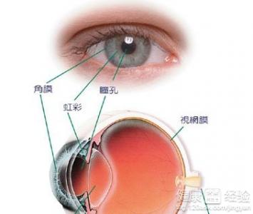 青光眼病人如何自我保健