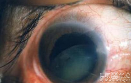第1步