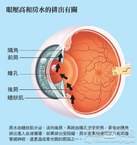 青光眼自我保健的5種方法