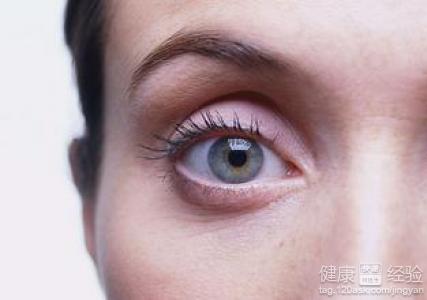 青光眼的早期症狀有哪些