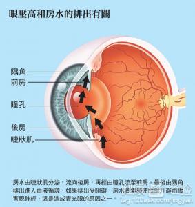 冬季老年人預防青光眼