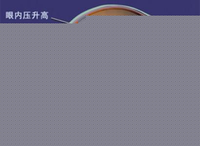 第2步