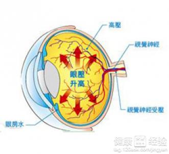 中醫如何治療青光眼