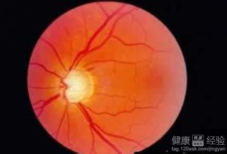 治療青光眼的最好方法