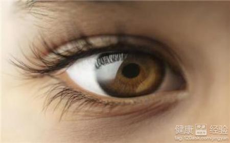青光眼是什麼症狀
