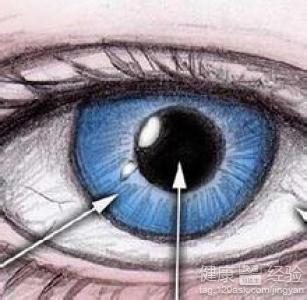 原發性青光眼怎麼治療