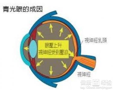 8歲男孩先鋒過敏是否會引起青光眼,要什麼護理