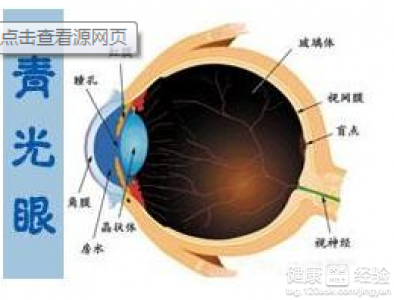 青光眼,右眼已經失明了,左眼要如何預防