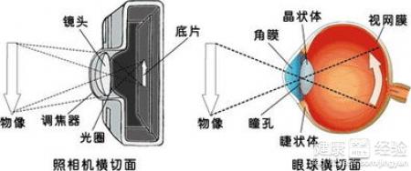 青光眼術後瞳孔移位能復位嗎