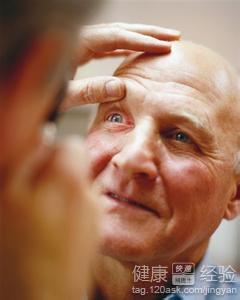 新生血管性青光眼能治好嗎