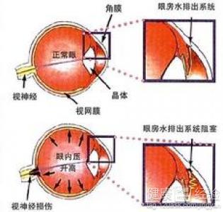 第2步