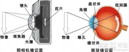 青光眼要注意的問題有哪些