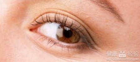 如何防止青光眼？