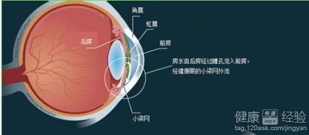 青光眼怎樣預防