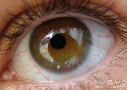 第1步