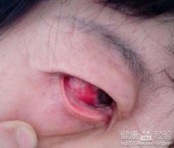 第1步