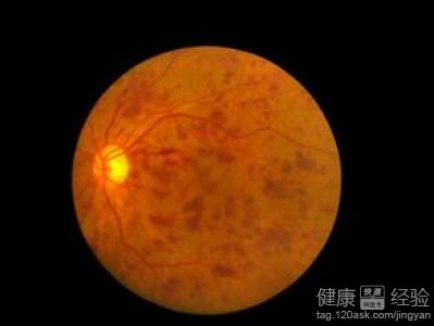 第2步
