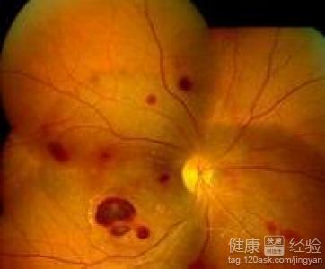 第1步