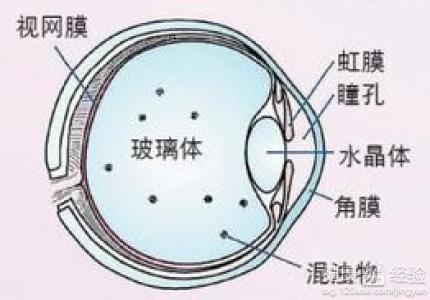 玻璃體積血怎麼辦