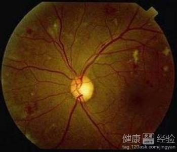 第1步