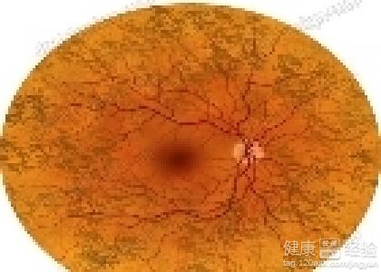 第1步