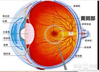 干性黃斑變性，看東西變形怎麼回事