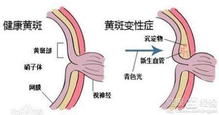 第1步
