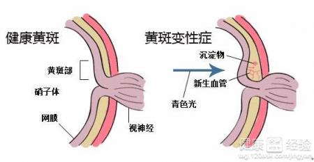 第1步