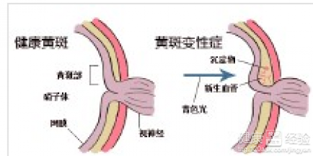 第1步