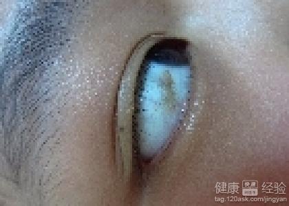 第1步