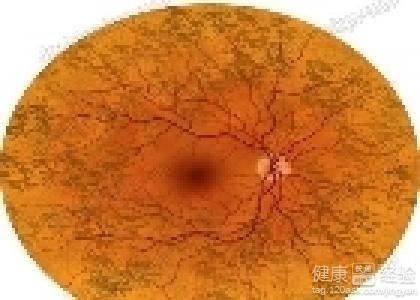 先天性視網膜黃斑變性會有什麼後果
