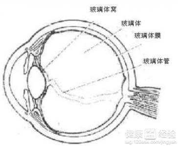 玻璃體混濁與黃斑變性如何區分