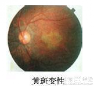 第2步