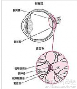 如何治療黃斑變性