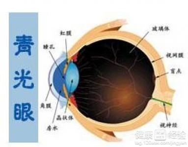 青光眼、黃斑變性發病原因以及防治措施